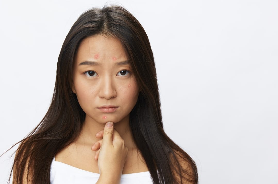 Understanding and Transforming Red and Irritated Skin